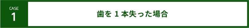 case1-歯を一本失った場合